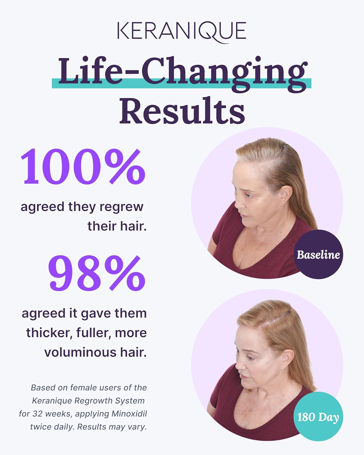 Keranique The Complete Hair Regrowth System for Deep Hydration