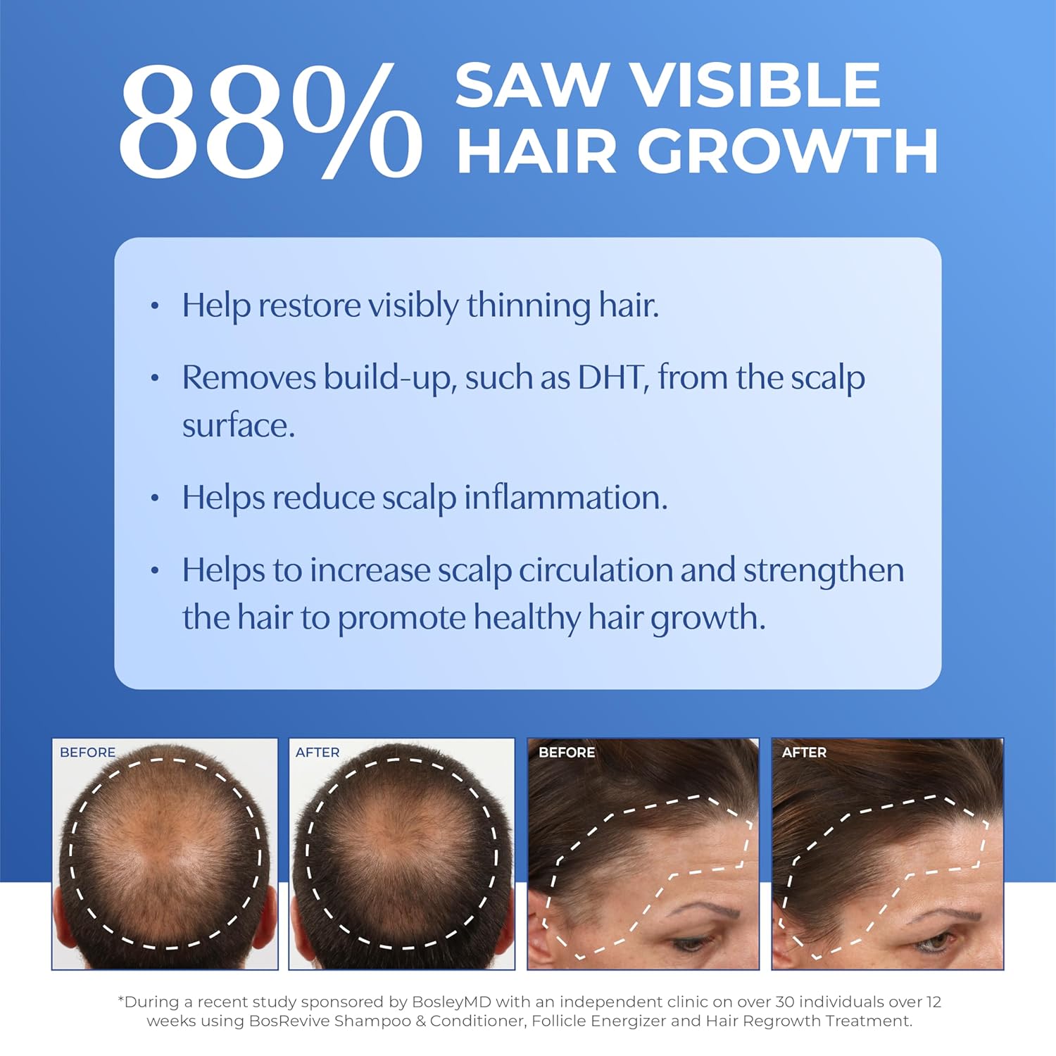 BosleyMD BOSRevive Thickening Treatment For Non Color-Treated Hair