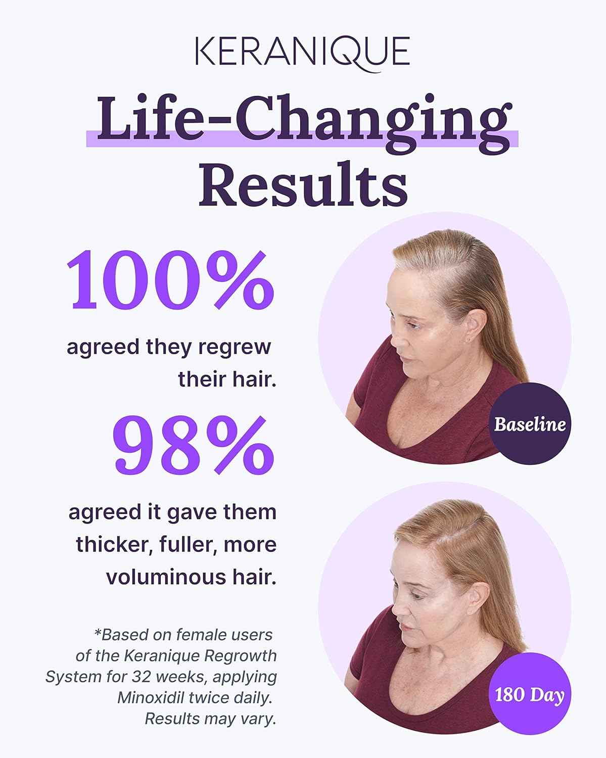 Keranique Regrowth Hair Foam for Women 60ml