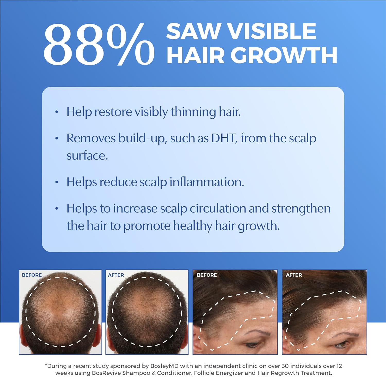 BosleyMD BOSRevive Non Color-Treated Hair Volumizing Conditioner
